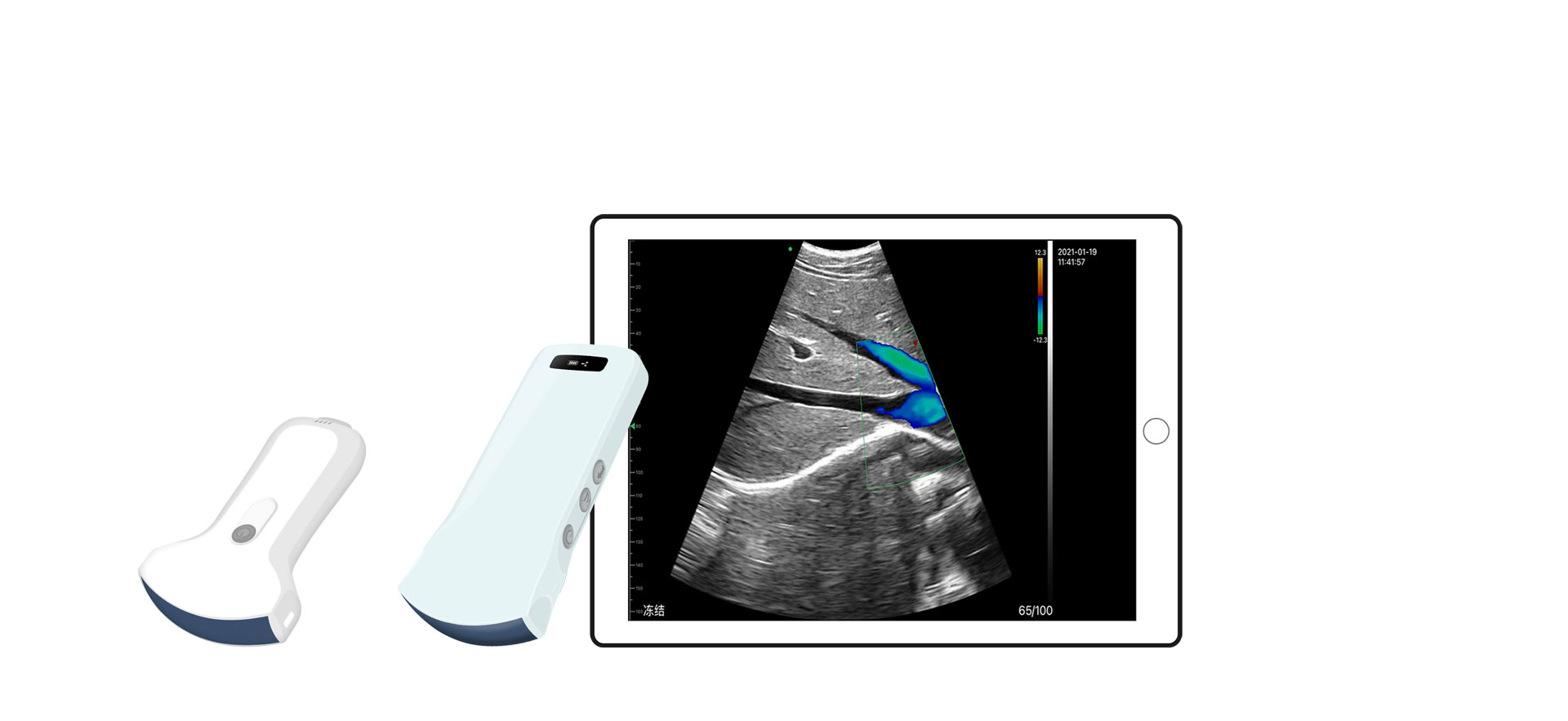 Apa saja aplikasi klinis dari probe Ultrasound abdomen?