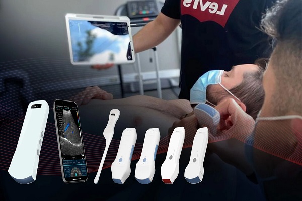 Probe Ultrasound nirkabel: alat revolusioner dalam bidang medis