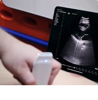 Probe Ultrasound nirkabel yang digunakan dalam cardiologi