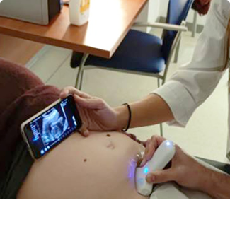 Probe Ultrasound nirkabel digunakan dalam OB & GYN