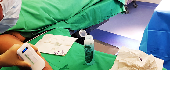 Probe Ultrasound nirkabel digunakan dalam anestesi
