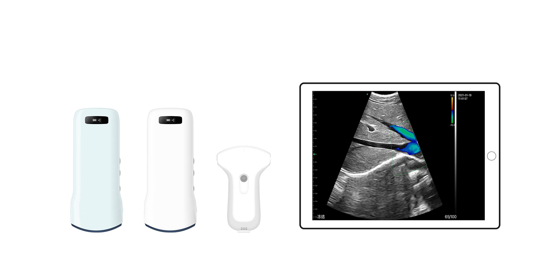 Probe cembung Ultrasound perut