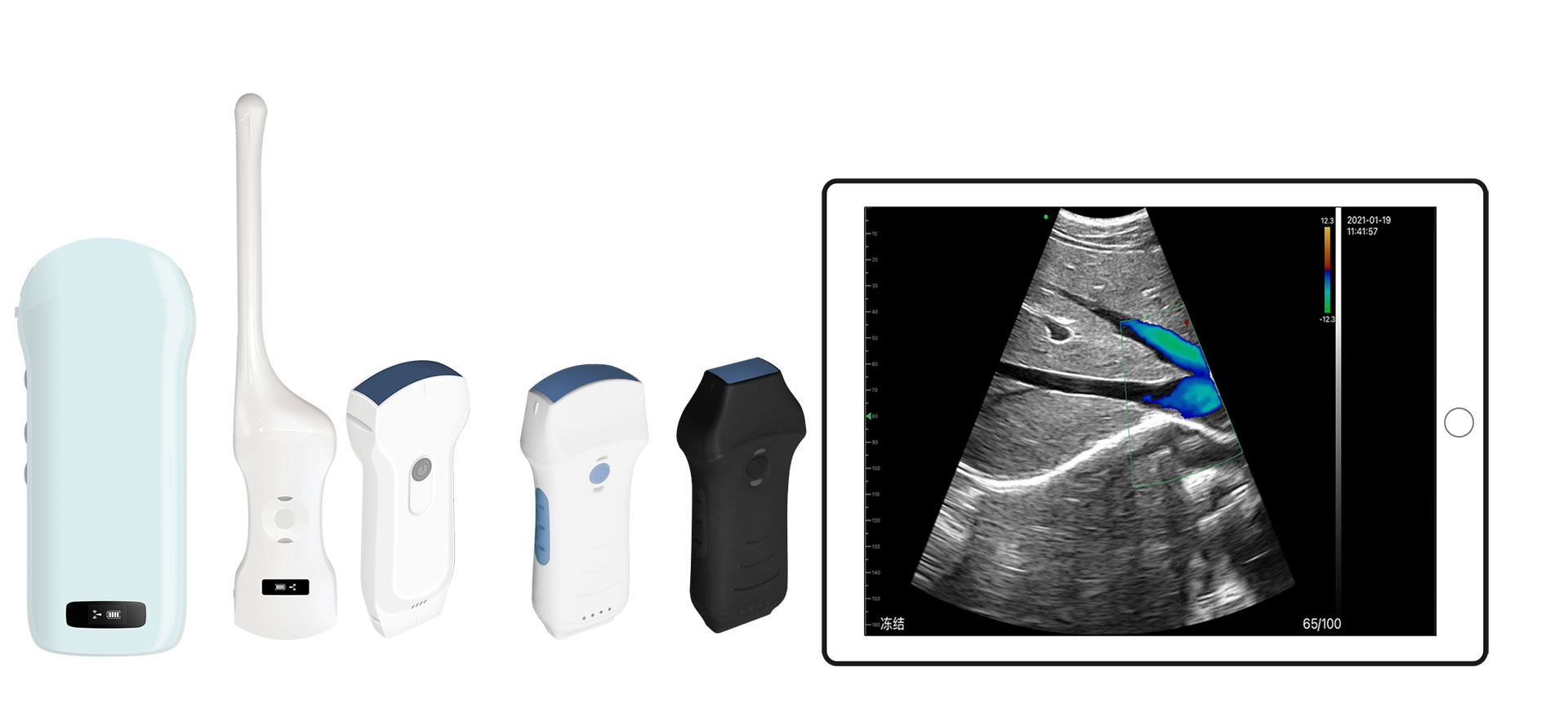 Diagnosis Ultrasound nirkabel khusus
