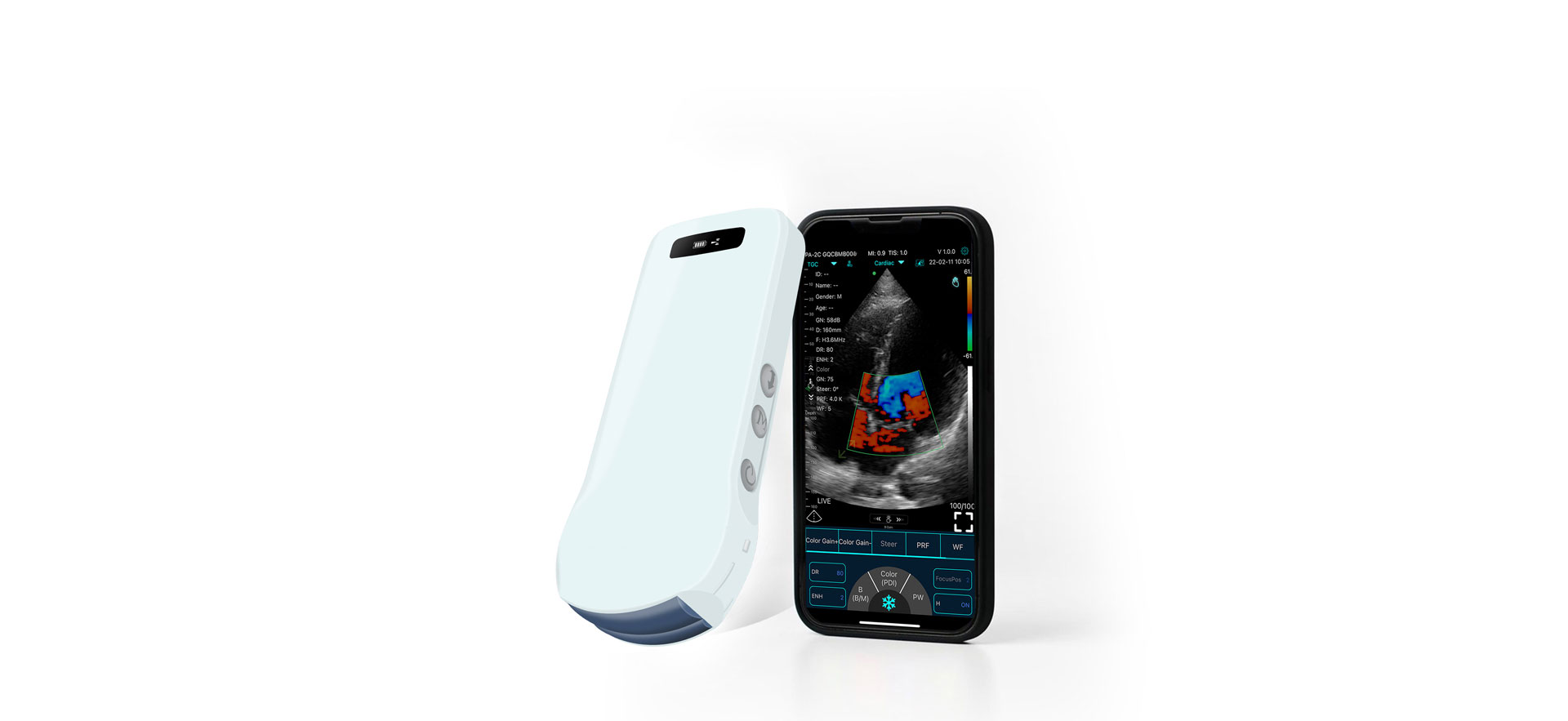 Ultrasound serbaguna satu Probe