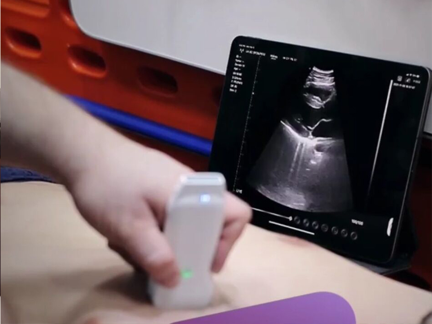 Probe Ultrasound nirkabel yang digunakan dalam cardiologi