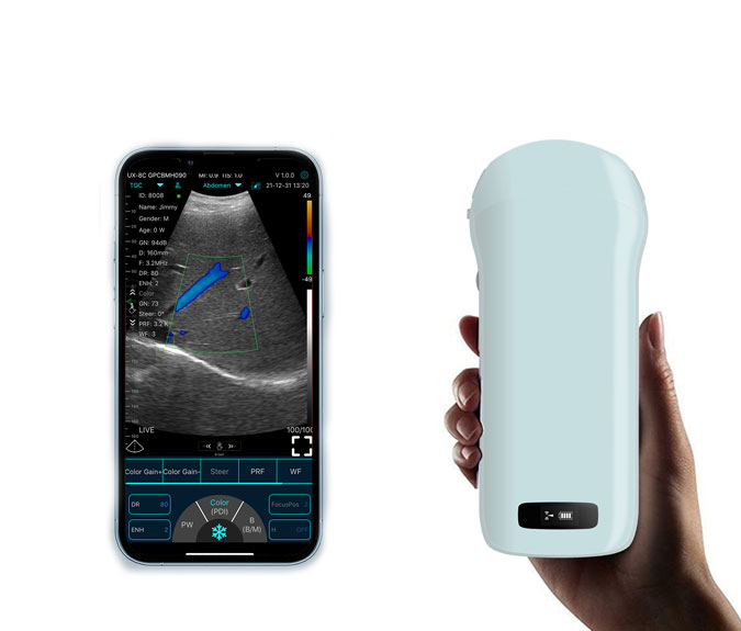 whole body abdomen ultrasound