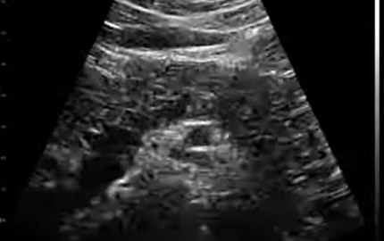 Ultrasound bagian penuh tubuh B