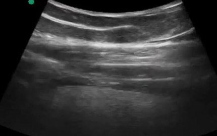 Transduser digunakan untuk Ultrasound perut C10RL paru