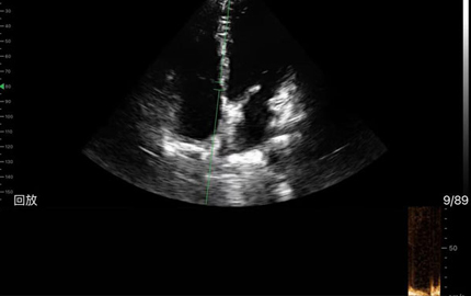 Mesin Ultrasound Portable Handheld