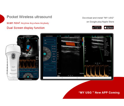 Fitur C10LN B & W pemeriksa Linear dasar Ultrasound Superfical