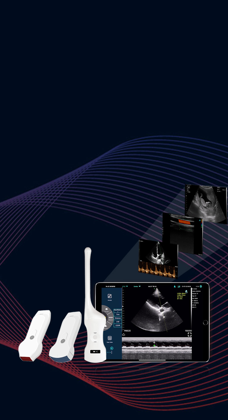 Probe ultrasound nirkabel Dual head