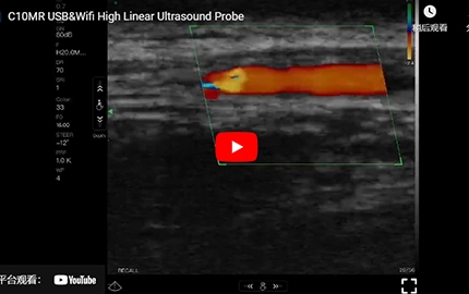 C10MR USB & Wifi Demo Ultrasound Linear tinggi