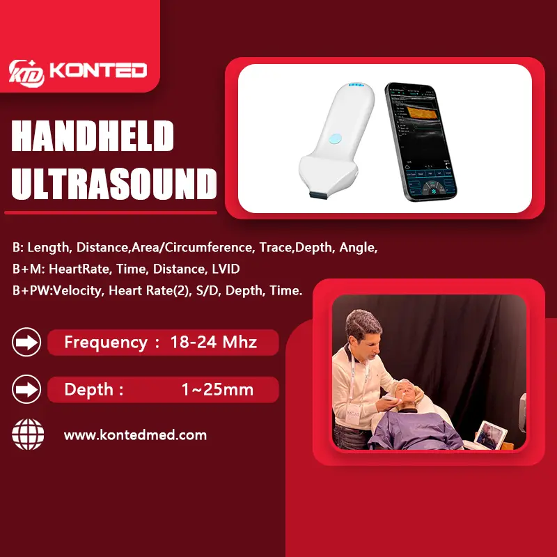 Konted C10MR array linear, fitur Ultrasound frekuensi tinggi