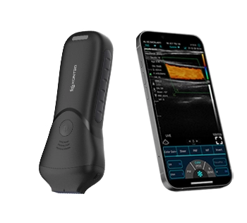 C10MS Pro USB & Wifi Probe Ultrasound Linear tinggi