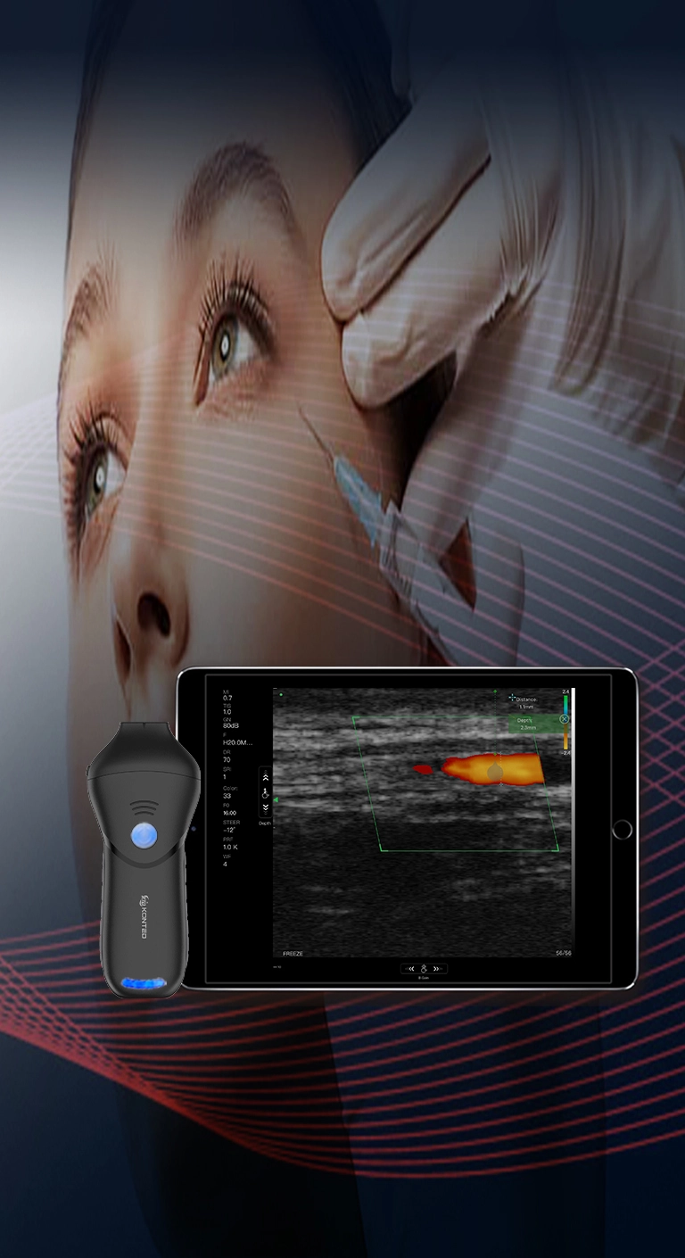 18-24mhz pemindai linear ultrasound wajah