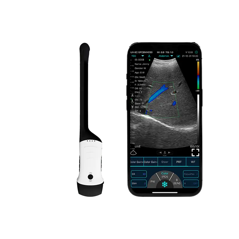 Pemindai Ultrasound genggam portabel membuka Era baru dalam pemeriksaan medis