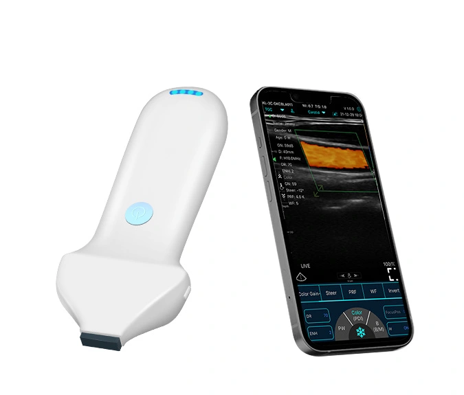 Aplikasi klinis Doppler warna Ultrasound